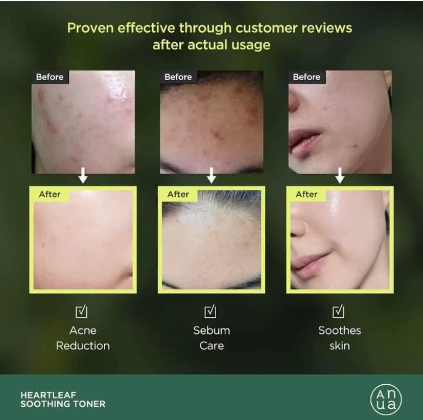 ANUA Heartleaf 77% Clear Pad 70pcs