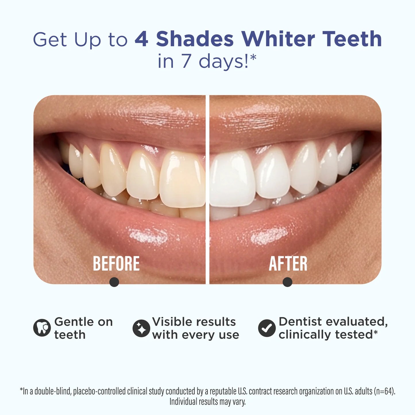 GuruNanda Premium Whitening Strips, 14 Strips