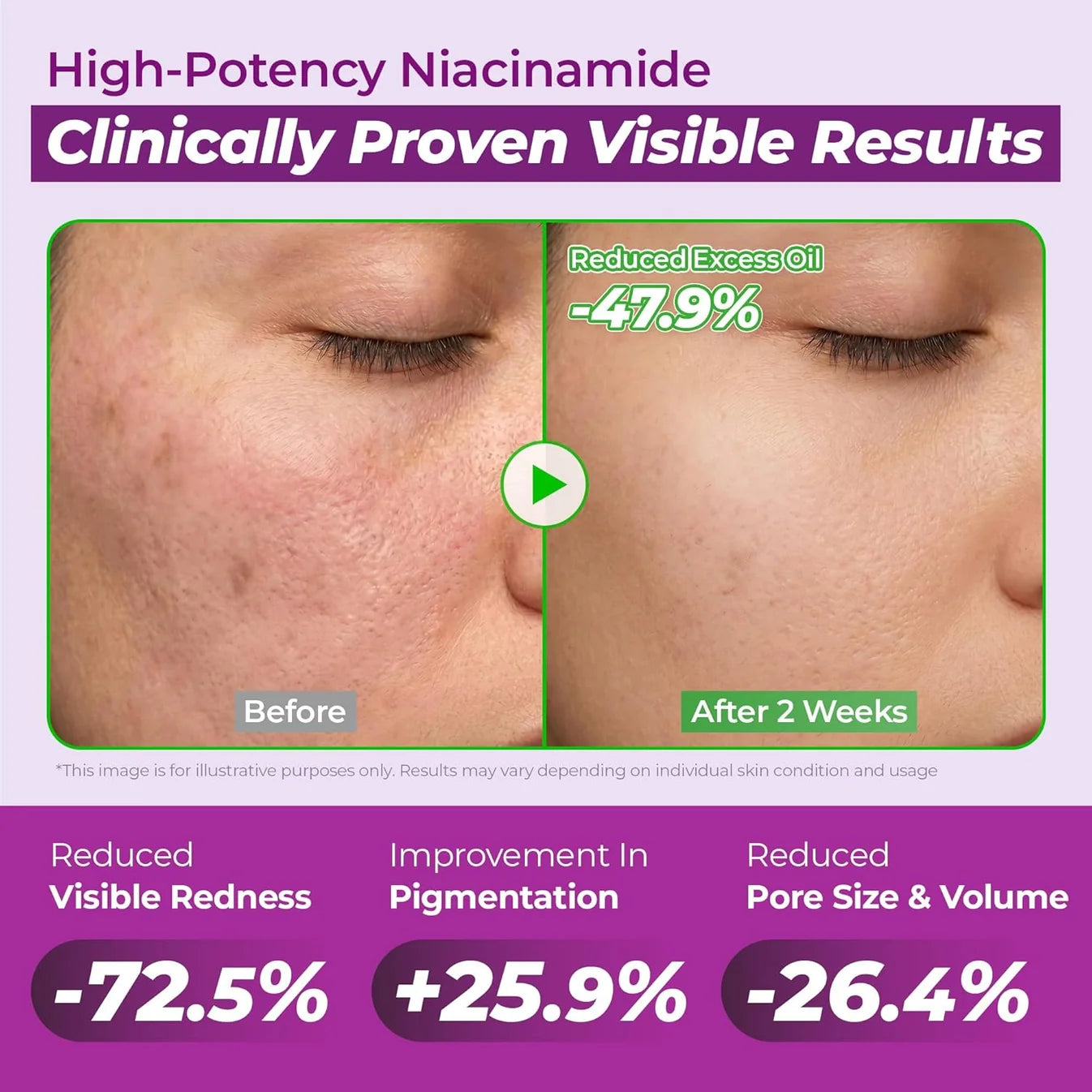 JUMISO Niacinamide 10 Serum – 40ml