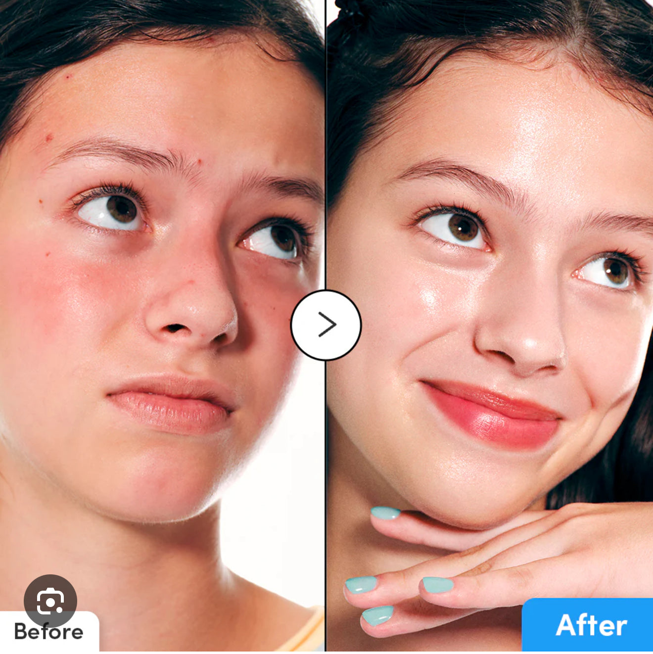 EQQUALBERRY Hyaltoin Flooding Serum 30ml