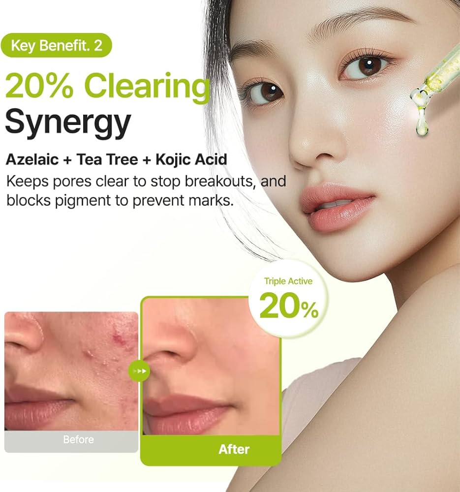 Purito Seoul Azelaic Acid 10 Kojic Tea Tree Serum 30ml