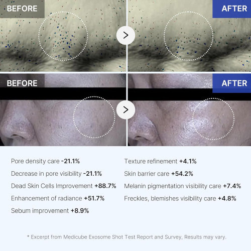 MEDICUBE One-Day Exosome Shot Pore Ampoule 2000 30ml