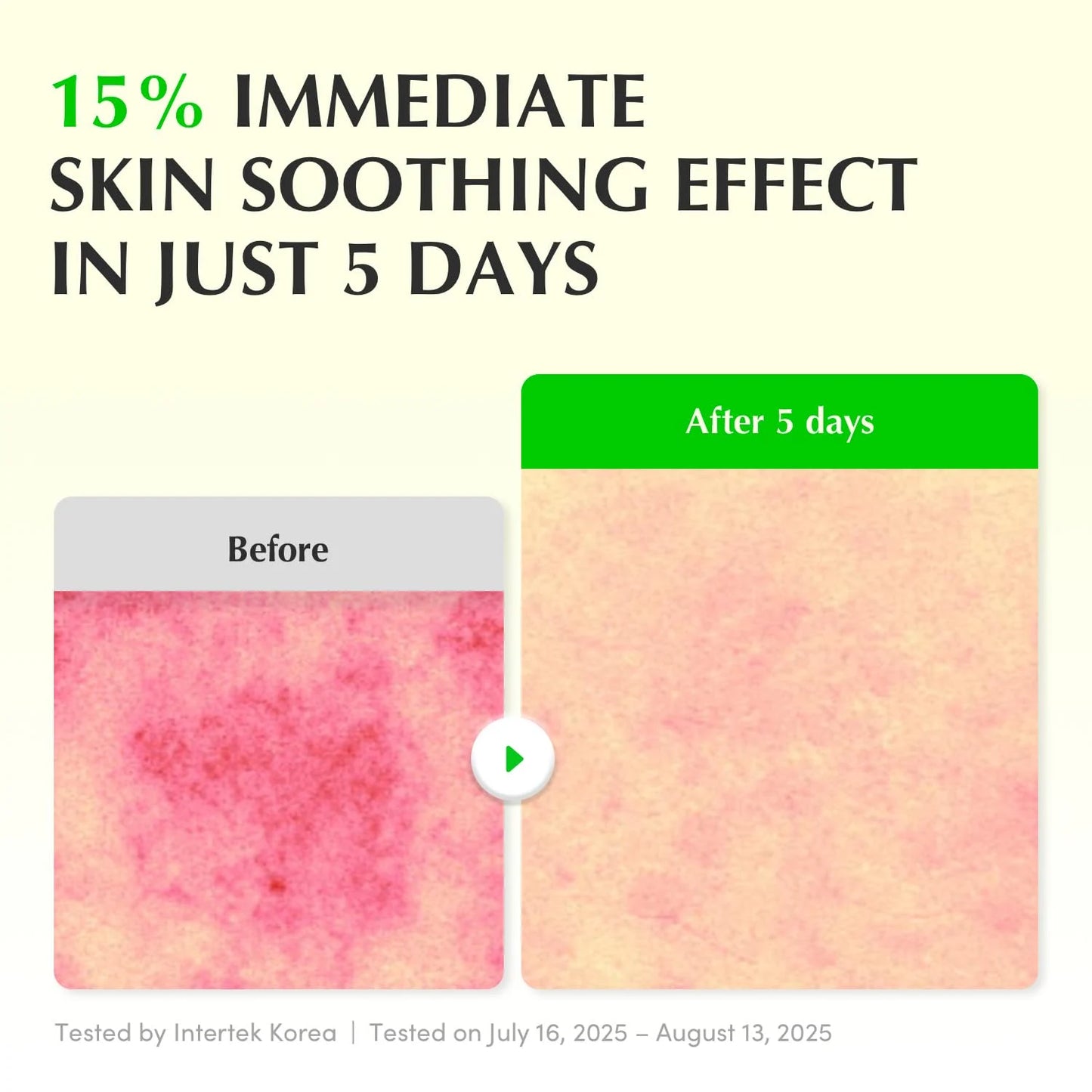 Eqqualberry Aloe PDRN Calming Smoothie Serum