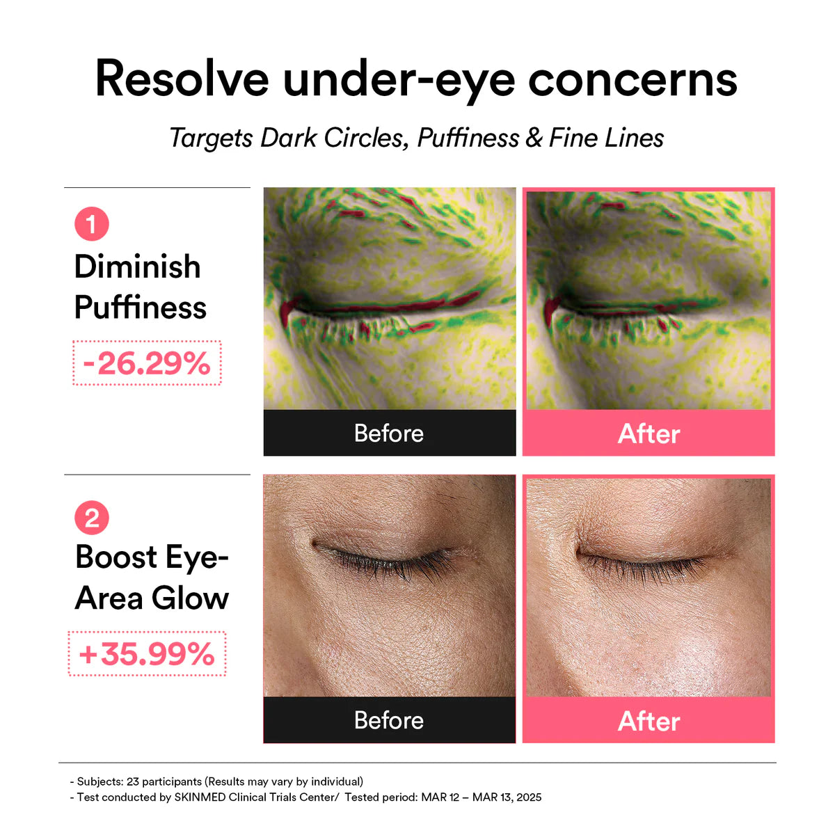 Abib PDRN retinal eye patch Glow jelly